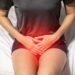 Infecções íntimas atingem maioria das mulheres: saiba reconhecer os sinais e como evitar