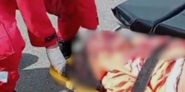 Gari morre após ser atropelada por motocicleta no AM
