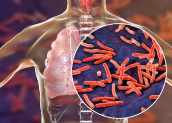 Amazonas reforça alerta para prevenção e diagnóstico precoce da tuberculose