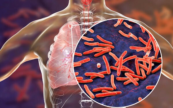 Amazonas reforça alerta para prevenção e diagnóstico precoce da tuberculose