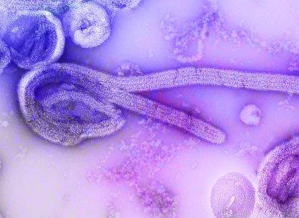 RS investiga caso suspeito de ebola na Grande Porto Alegre