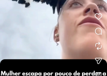 Mulher escapa por pouco de perder a visão após ataque de pássaro impressionar nas redes sociais