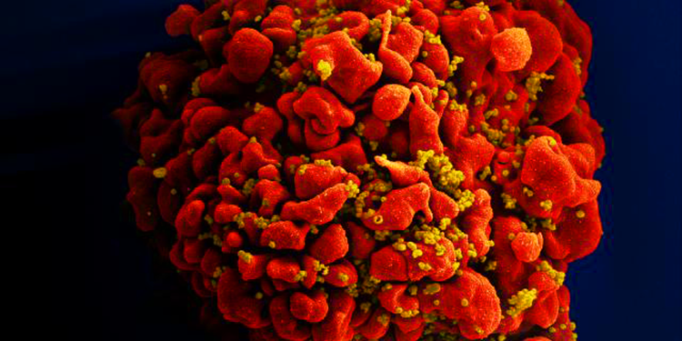 HIV: dois novos casos de cura são anunciados; total chega a 13