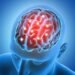 “Marcapasso cerebral”: como funciona tecnologia que trata Parkinson e TOC