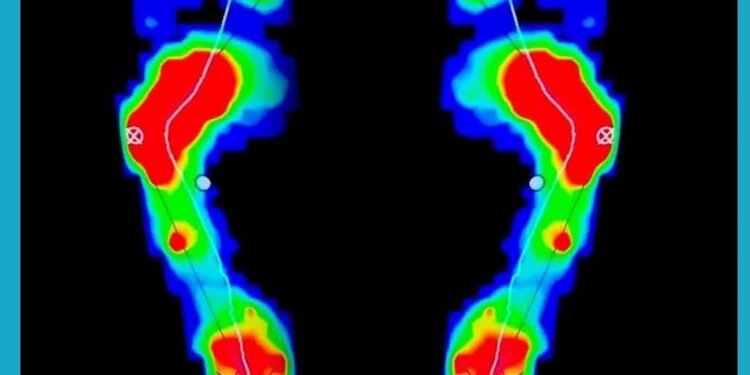 Pisada errada pode explicar dores e lesões em todo o corpo