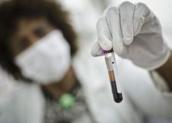 Novo exame de sangue pode prever Alzheimer anos antes, diz estudo