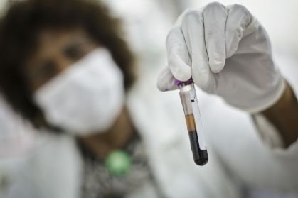 Novo exame de sangue pode prever Alzheimer anos antes, diz estudo