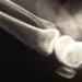 Descoberto há 130 anos, raio-X continua revolucionando a medicina