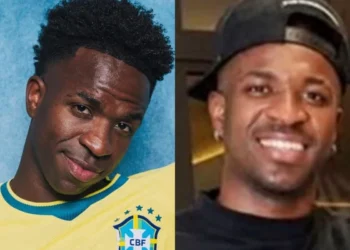 Vini Jr.: harmonização melhora rosto, mas não a respiração pela boca