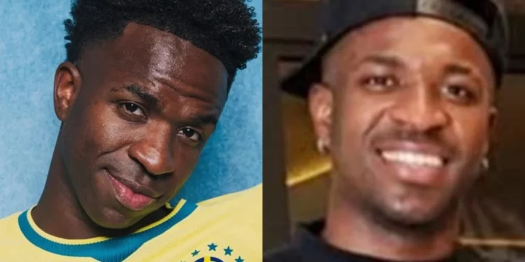 Vini Jr.: harmonização melhora rosto, mas não a respiração pela boca