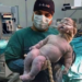 Bebê nasce com 7,9 kg em parto vaginal e surpreende equipe médica