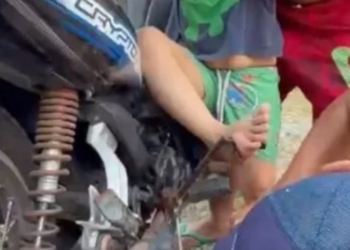 Criança de 4 anos fica ferida após pé ficar preso em pedal de moto no AM
