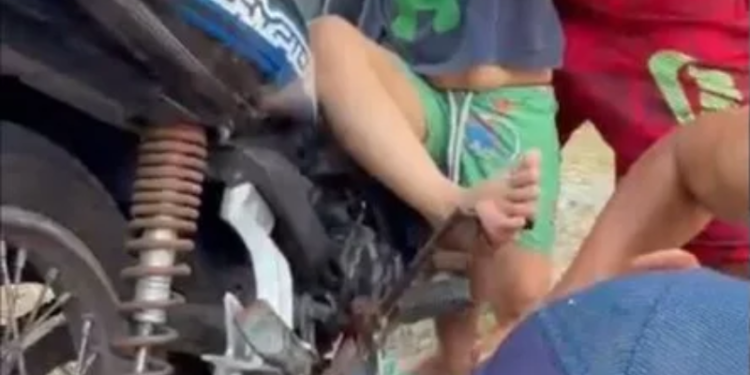 Criança de 4 anos fica ferida após pé ficar preso em pedal de moto no AM