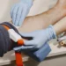 Doação de sangue: novas regras reduzem espera após tatuagem e piercing