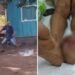 Tentativa de apagar explosivo com o pé termina em tragédia e homem sofre amputação dos dedos