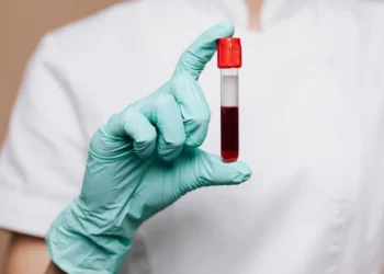 Estudo investiga se há risco de transmissão do Alzheimer pelo sangue