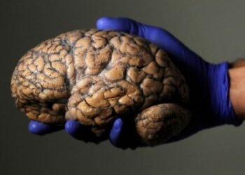 Alguns cérebros humanos não apodrecem: entenda quais são eles e por quê
