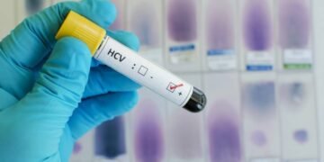 Hepatites virais exigem diferentes formas de prevenção e cuidado; saiba o que o SUS oferece