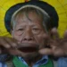Cacique Raoni é diagnosticado com câncer e recebe cuidados paliativos