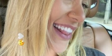Diamante no dente: quais os riscos de procedimento de Virginia Fonseca após fazer um ‘V’ de Vini Jr