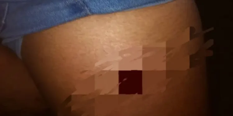 Mulher leva tiro de raspão na perna após retornar de festa no Interior do Amazonas