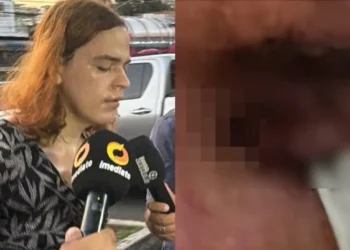 Padrasto tem os dois globos oculares removidos após ataque brutal de enteada trans em Manaus