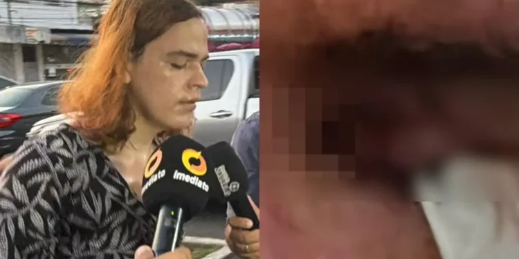 Padrasto tem os dois globos oculares removidos após ataque brutal de enteada trans em Manaus