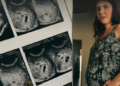 Mãe faz exame para ver um bebê e choca médico ao descobrir quíntuplos