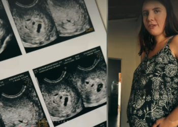 Mãe faz exame para ver um bebê e choca médico ao descobrir quíntuplos