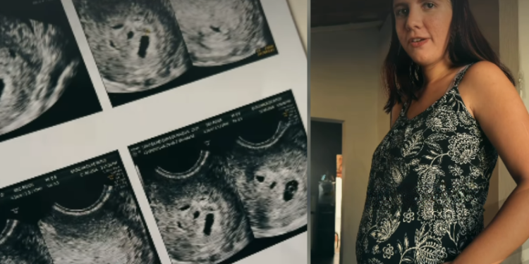 Mãe faz exame para ver um bebê e choca médico ao descobrir quíntuplos