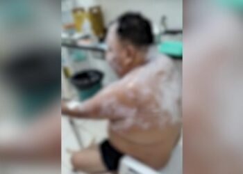 Homem é ferido após suspeito lançar gasolina em residência e provocar incêndio em Barreirinha