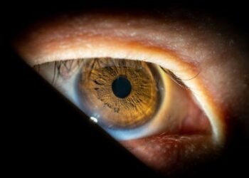Cirurgia única para tratar glaucoma e catarata será oferecida pelo SUS