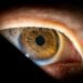Cirurgia única para tratar glaucoma e catarata será oferecida pelo SUS