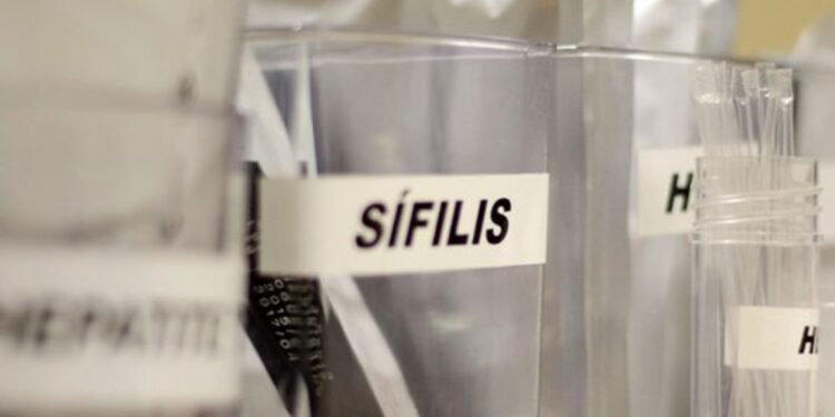 Sífilis congênita cresce 37,5% em Manaus e acende alerta para gestantes