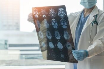 Seus hábitos podem aumentar o risco de AVC? Saiba como prevenir doença