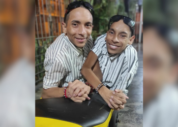 Gêmeos siameses equatorianos morrem aos 27 anos com poucas horas de diferença após emergência médica