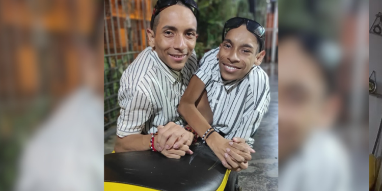 Gêmeos siameses equatorianos morrem aos 27 anos com poucas horas de diferença após emergência médica