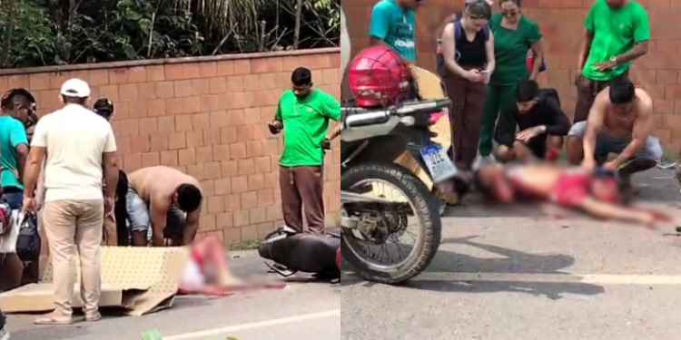 Motociclista fica sem perna após grave acidente na zona oeste de Manaus